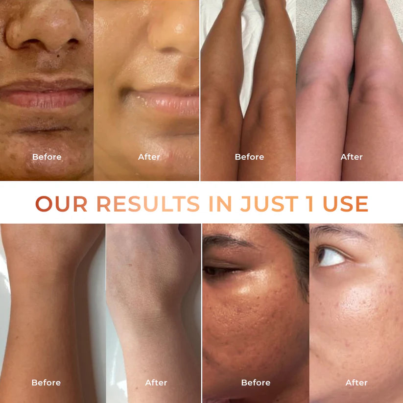 Gloriva life Tan Vanish Gluta-Kojic Skin Polish B2B